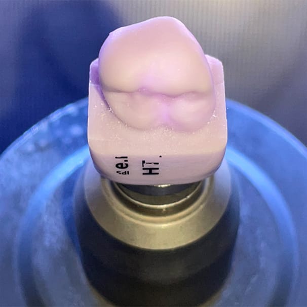 A Cerec Crown being formed
