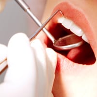 image of restorative fillings